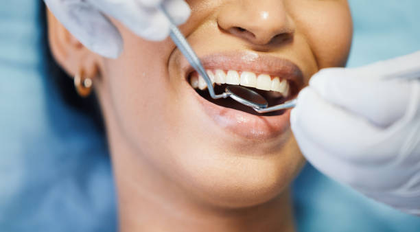 Best Teeth Whitening  in Shorewood, IL